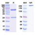 Anti-Human Mesothelin Reference Antibody (Amatuximab, RUO) Anti-Human Mesothelin Reference Antibody (Amatuximab, RUO)