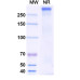 Anti-HRSV F/F protein Reference Antibody (HNK20) Anti-HRSV F/F protein Reference Antibody (HNK20)