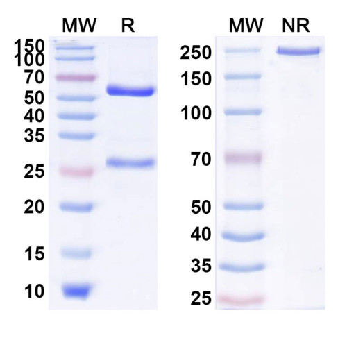 Anti-Human IL17RB Reference Antibody (SM17) Anti-Human IL17RB Reference Antibody (SM17)