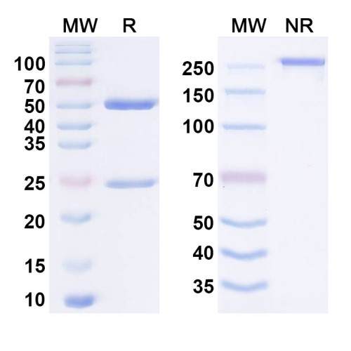 Anti-SARS-CoV-2 Spikeprotein (RBD) Reference Antibody (BA7535) Anti-SARS-CoV-2 Spikeprotein (RBD) Reference Antibody (BA7535)