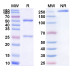 Anti-Human VEGF Reference Antibody (Bevacizumab, RUO) Anti-Human VEGF Reference Antibody (Bevacizumab, RUO)
