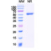 Anti-Human CD19 & CD3E Bispecific Reference Antibody (Blinatumomab, RUO) Anti-Human CD19 & CD3E Bispecific Reference Antibody (Blinatumomab, RUO)