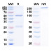Anti-Human CEACAM-5/CD66e Reference Antibody (Cergutuzumab, RUO) Anti-Human CEACAM-5/CD66e Reference Antibody (Cergutuzumab, RUO)