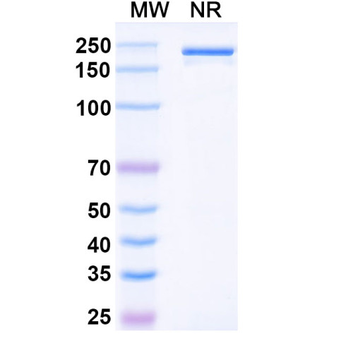Anti-Human TRANCE/TNFSF11/RANK L Reference Antibody (Denosumab, RUO) Anti-Human TRANCE/TNFSF11/RANK L Reference Antibody (Denosumab, RUO)