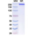 Anti-Human 4-1BB Ligand/TNFSF9 Reference Antibody (Evunzekibart, RUO) Anti-Human 4-1BB Ligand/TNFSF9 Reference Antibody (Evunzekibart, RUO)