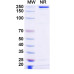 Anti-Human BCMA/TNFRSF17 Reference Antibody (Ispectamab, RUO) Anti-Human BCMA/TNFRSF17 Reference Antibody (Ispectamab, RUO)