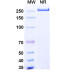 Anti-HIV-1 gp120 Reference Antibody (Lafuvitug, RUO) Anti-HIV-1 gp120 Reference Antibody (Lafuvitug, RUO)