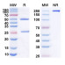 Anti-Human TRAIL R2/TNFRSF10B Reference Antibody (Lexatumumab, RUO) Anti-Human TRAIL R2/TNFRSF10B Reference Antibody (Lexatumumab, RUO)