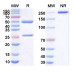 Anti-Human TRAILR1/TNFRSF10A Reference Antibody (Mapatumumab, RUO) Anti-Human TRAILR1/TNFRSF10A Reference Antibody (Mapatumumab, RUO)
