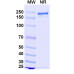 Anti-Human IL-6 Reference Antibody (Pacibekitug, RUO)
