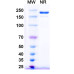 Anti-Human DPEP3 Reference Antibody (Pintumomab, RUO) Anti-Human DPEP3 Reference Antibody (Pintumomab, RUO)