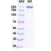 Anti-SARS-CoV-2 RBD Reference Antibody (Plutavimab, RUO)