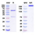 Anti-Human SOST/Sclerostin Reference Antibody (Romosozumab, RUO) Anti-Human SOST/Sclerostin Reference Antibody (Romosozumab, RUO)
