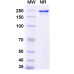 Anti-SARS-CoV-2 (2019-nCoV) RBD Reference Antibody (Sotrovimab, RUO)