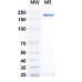 Anti-Human IGF-I R/IGF1R Reference Antibody (Teprotumumab, RUO) Anti-Human IGF-I R/IGF1R Reference Antibody (Teprotumumab, RUO)