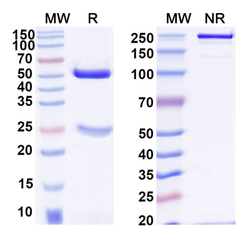 Anti-Human CD20/MS4A1 Antibody (SAA2210) Anti-Human CD20/MS4A1 Antibody (SAA2210)