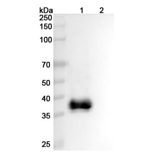 Anti-Human CD301/CLEC10A Antibody (49C11)