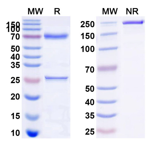 Anti-Human CD62E/SELE Antibody (164#)