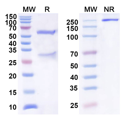 Anti-Human CXCL9/MIG Antibody (SAA0465)