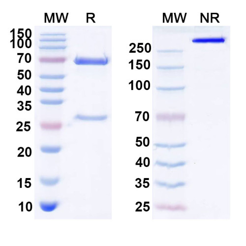 Anti-Human GDF11/BMP11 Antibody (SAA0430) Anti-Human GDF11/BMP11 Antibody (SAA0430)