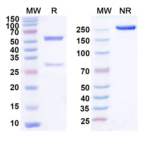 Anti-Human PDGFB Antibody (SAA0449) Anti-Human PDGFB Antibody (SAA0449)