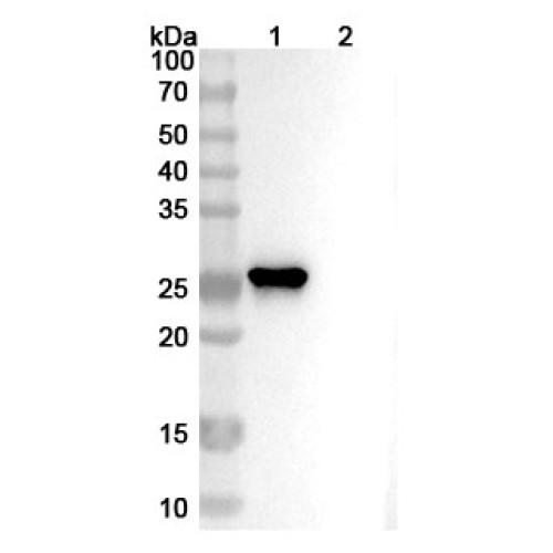 Anti-Human ROBO4 Antibody (MAb1) Anti-Human ROBO4 Antibody (MAb1)