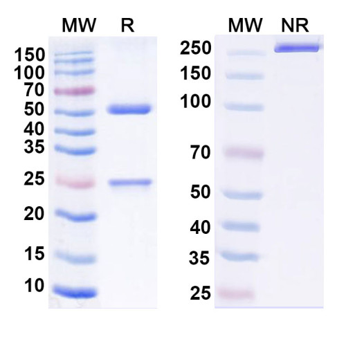 Anti-Mycobacterium tuberculosis pstS1 Antibody (SAA2170)