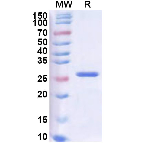 ASFV MGF_360-4L Recombinant Protein (N-His-SUMO)