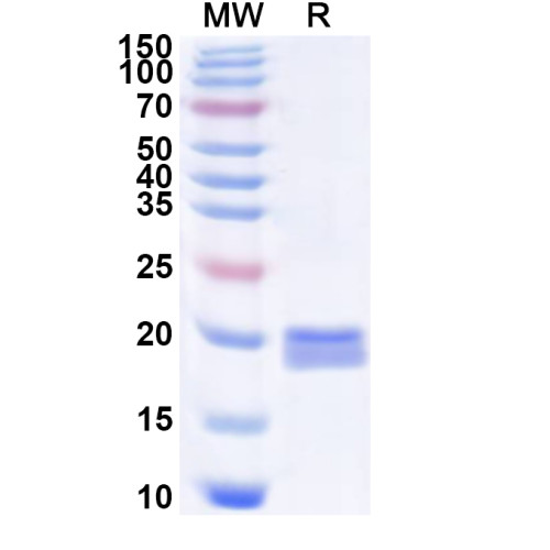 EV71 P2A/Protease 2A Recombinant Protein (N-His) EV71 P2A/Protease 2A Recombinant Protein (N-His)