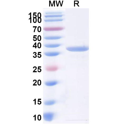 Human AKR1B1 Recombinant Protein (N-His)
