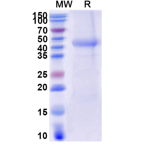Human CD116/CSF2RA Recombinant Protein (C-His) Human CD116/CSF2RA Recombinant Protein (C-His)
