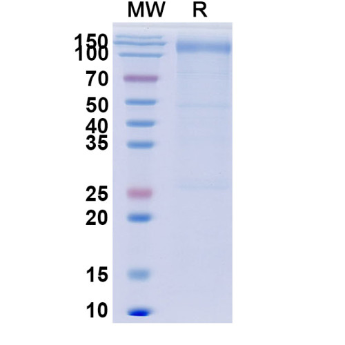 Human CD118/LIFR Recombinant Protein (C-His) Human CD118/LIFR Recombinant Protein (C-His)