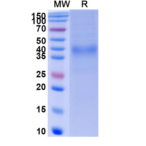 Human CD158d/KIR2DL4 Recombinant Protein (C-His) Human CD158d/KIR2DL4 Recombinant Protein (C-His)