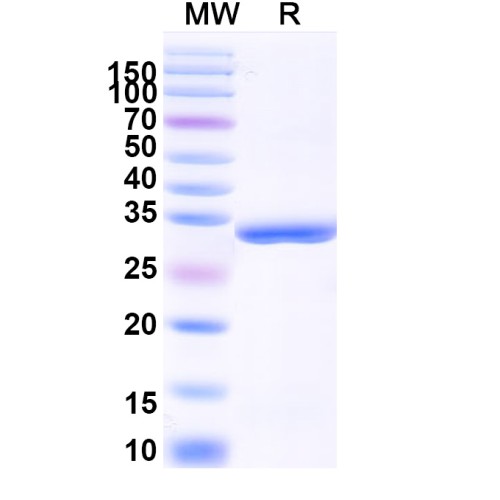 Human CD254/RANKL/TNFSF11 Recombinant Protein (N-His)