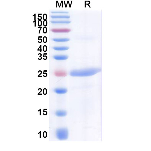 Human CD319/SLAMF7 Recombinant Protein (N-His)