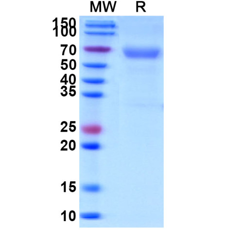 Human CD320 Recombinant Protein (C-Fc) Human CD320 Recombinant Protein (C-Fc)