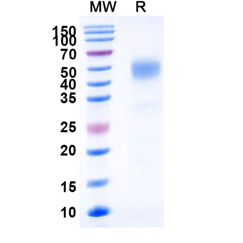Human CD332/FGFR2 Recombinant Protein (C-His) Human CD332/FGFR2 Recombinant Protein (C-His)