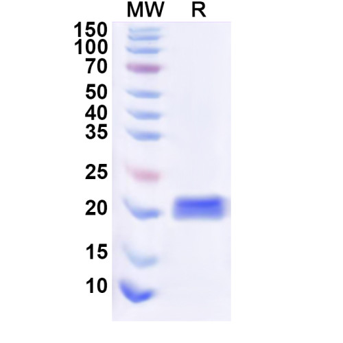 Human CD368/CLEC4D Recombinant Protein (N-His) Human CD368/CLEC4D Recombinant Protein (N-His)