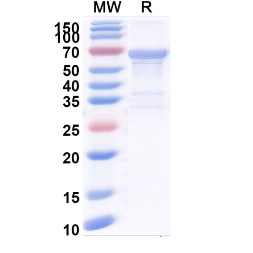 Human CEMIP Recombinant Protein (N-His) Human CEMIP Recombinant Protein (N-His)