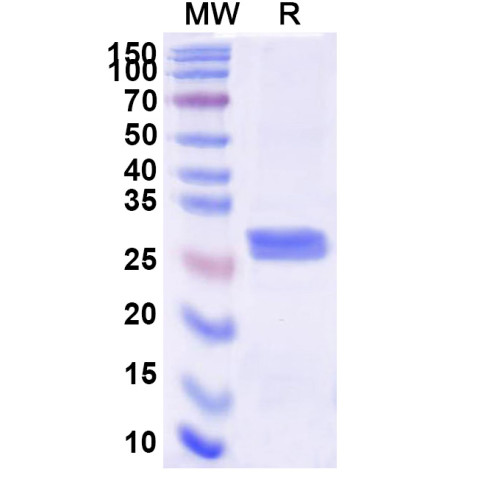 Human CFD Recombinant Protein (C-His)