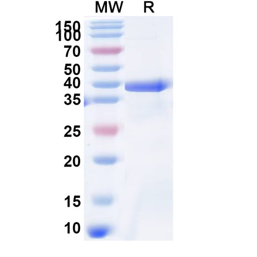 Human COL6A2 Recombinant Protein (N-His) Human COL6A2 Recombinant Protein (N-His)