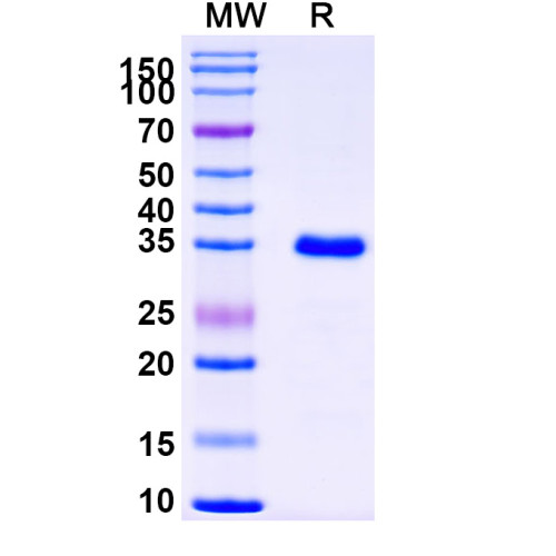 Human DNMT3A Recombinant Protein (N-His) Human DNMT3A Recombinant Protein (N-His)