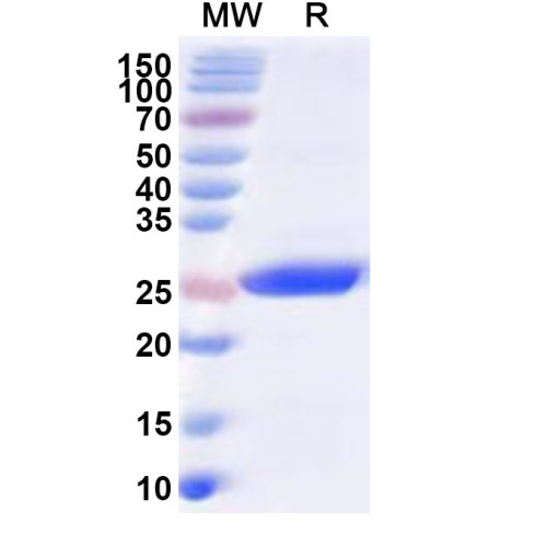 Human DSP Recombinant Protein (N-His)