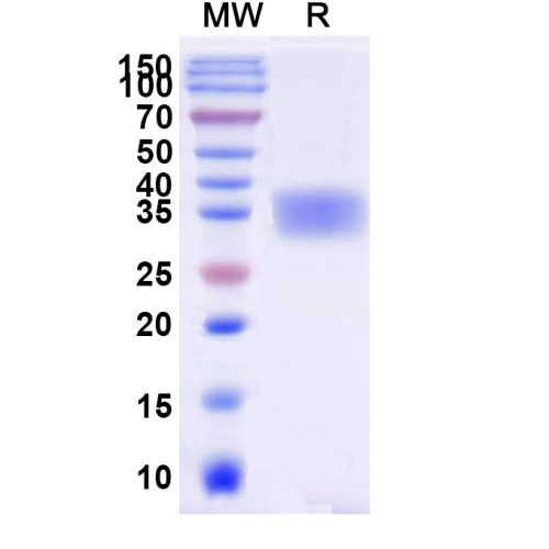 Human EPO Recombinant Protein (C-His)
