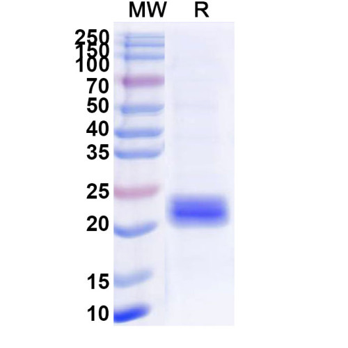 Human GLUT4/SLC2A4 Recombinant Protein (N-His-SUMO) Human GLUT4/SLC2A4 Recombinant Protein (N-His-SUMO)