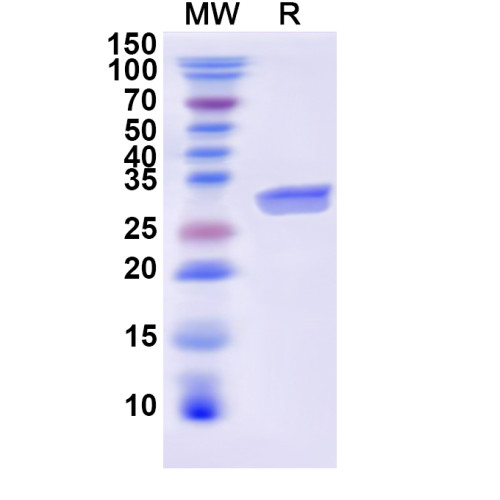 Human GRP Recombinant Protein (N-His-KSI) Human GRP Recombinant Protein (N-His-KSI)
