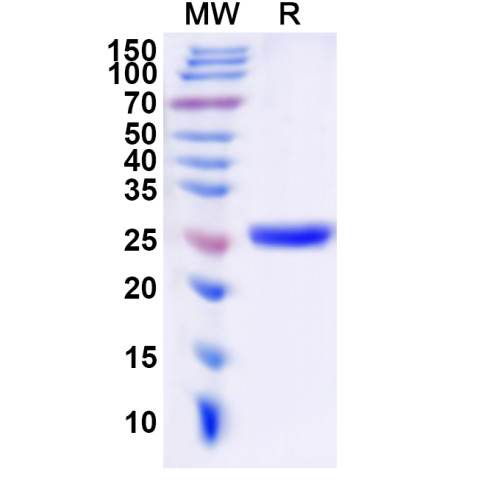 Human HTR2C Recombinant Protein (N-His-KSI) Human HTR2C Recombinant Protein (N-His-KSI)