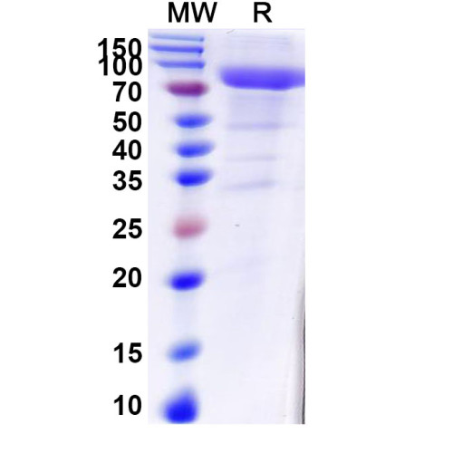 Human KLKB1 Recombinant Protein (C-His) Human KLKB1 Recombinant Protein (C-His)