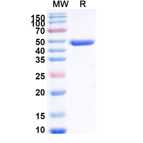 Human KRAS/K-Ras 2 (G12D) Recombinant Protein (N-GST) Human KRAS/K-Ras 2 (G12D) Recombinant Protein (N-GST)
