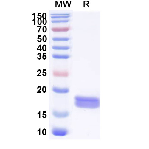 Human LC3B/MAP1LC3B Recombinant Protein (N-His)